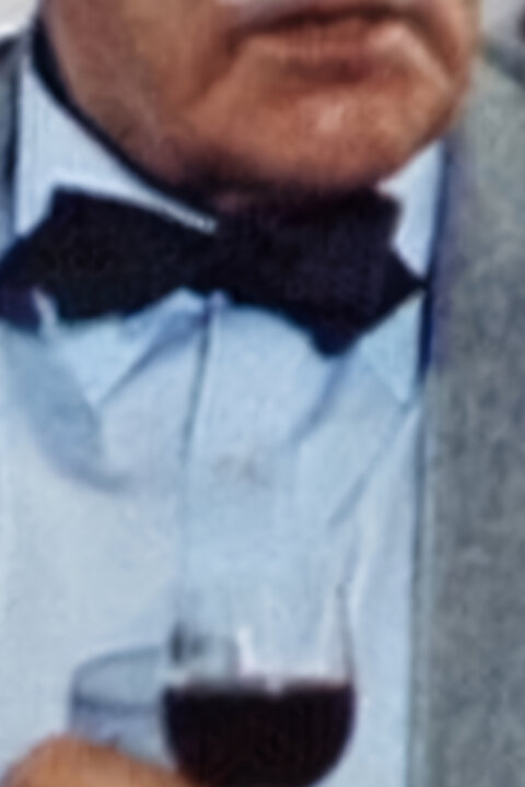 Španělská paradentóza